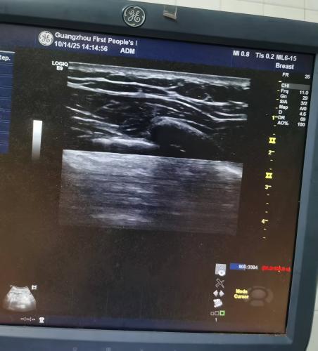 GE LOGIQ E9彩超维修