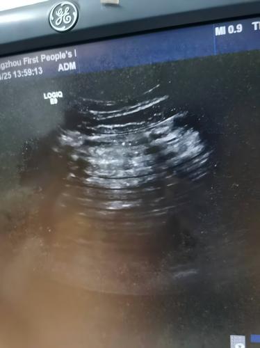 GE LOGIQ E9彩超4387-2.jpg