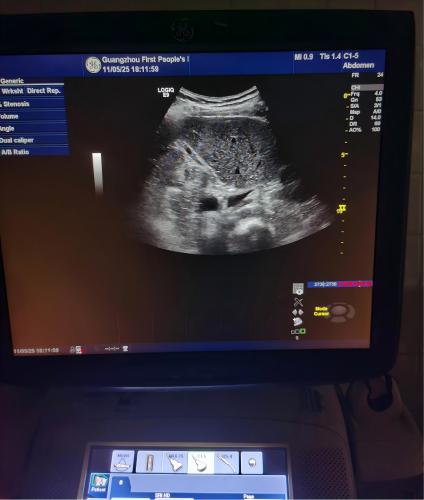 GE LOGIQ E9彩超4387-3.jpg