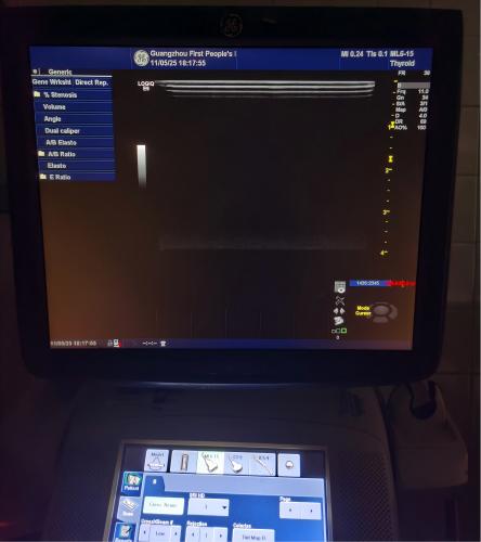 GE LOGIQ E9彩超4387-4.jpg