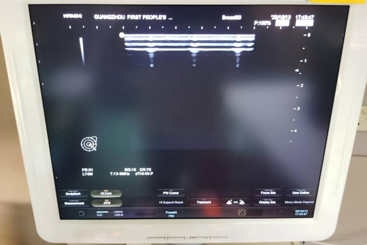 日立HIVISION Viusa彩超维修
