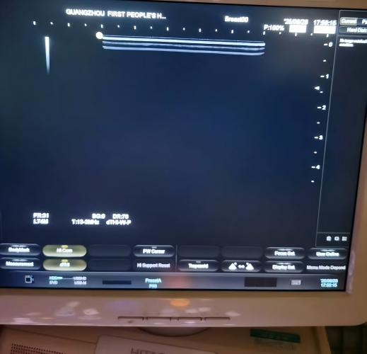 日立HIVISION Viusa彩超更换RDBF板4364-2.jpg